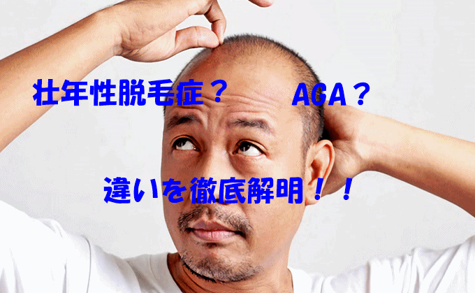 壮年性脱毛症とAGAは何がどう違うのかを詳しく解説している画像
