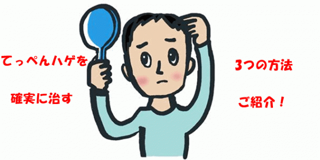 てっぺんハゲの原因と治すためにできる改善方法とは？